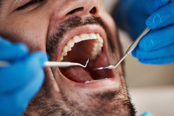 Best Broken Tooth Emergency  in Meridian, CO